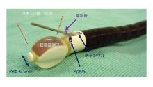 適切治療提供へ進歩　リンパ節に超音波活用　肺がんの診断（気管支鏡）　千葉県がんセンター呼吸器内科部長　新行内雅斗　【９月はがん征圧月間　ちば　がんにうち克つ】（１１）
