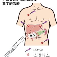 化学療法、再発少なく　微小細胞への効果期待　胆道・膵臓がん治療の進歩　千葉県がんセンター肝胆膵外科部長　賀川真吾　【９月はがん征圧月間　ちば　がんにうち克つ】（６）